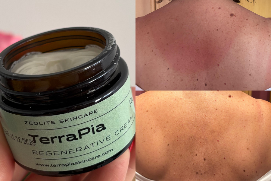 terrapia_regenerativna_krema_zeolit_opekline_od_sunca
