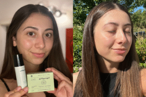 prirodna-kozmetika-rezultati-naslovna-terrapiaskincare