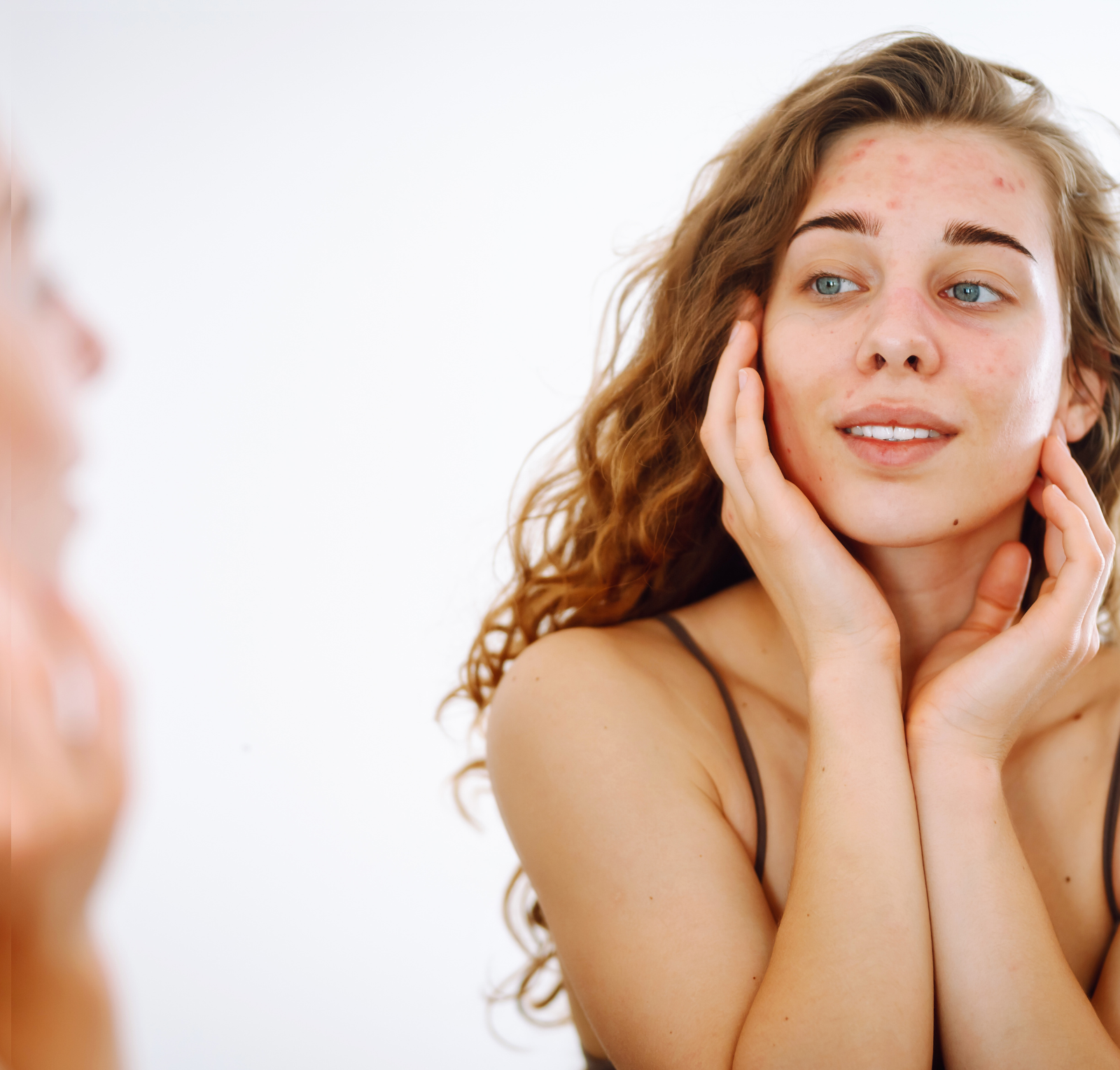 masna-koza-terrapiaskincare